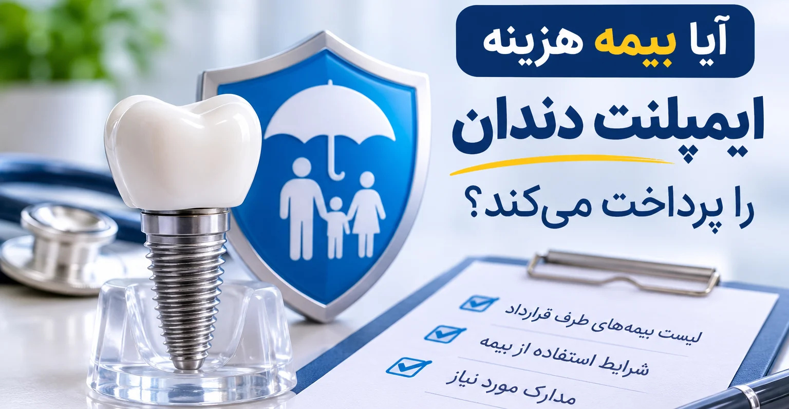کدام بیمه هزینه ایمپلنت را می دهد ؟